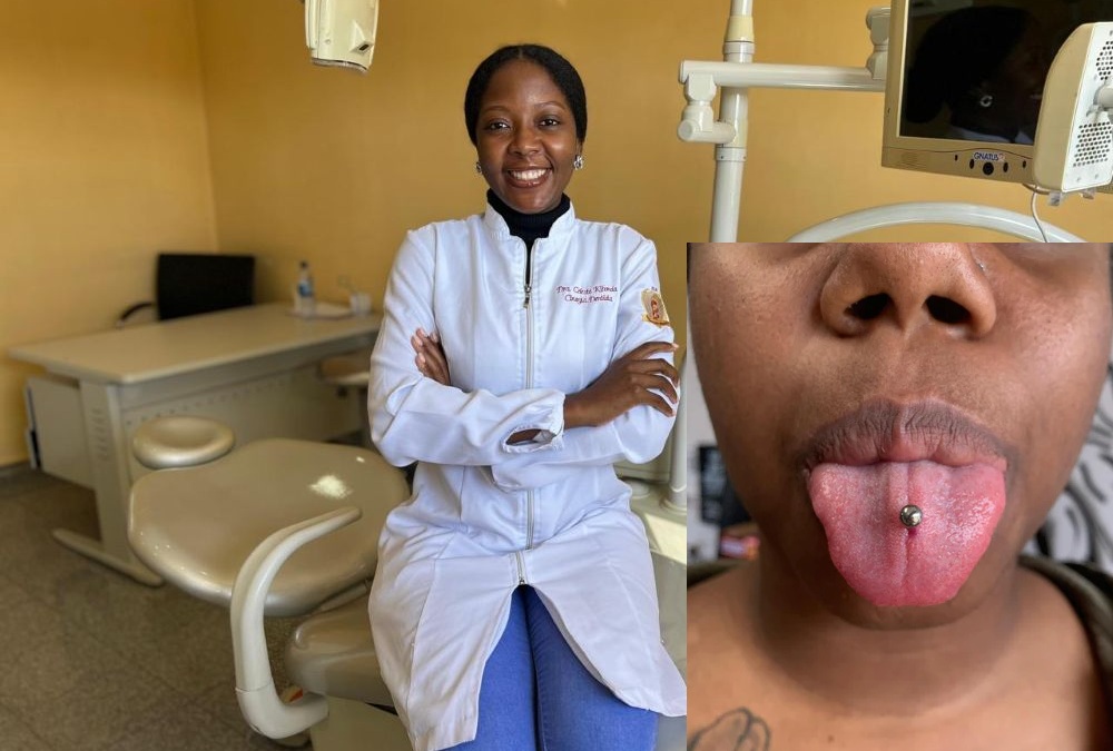 Médica alerta que uso do piercing na língua causa sérios problemas de saúde