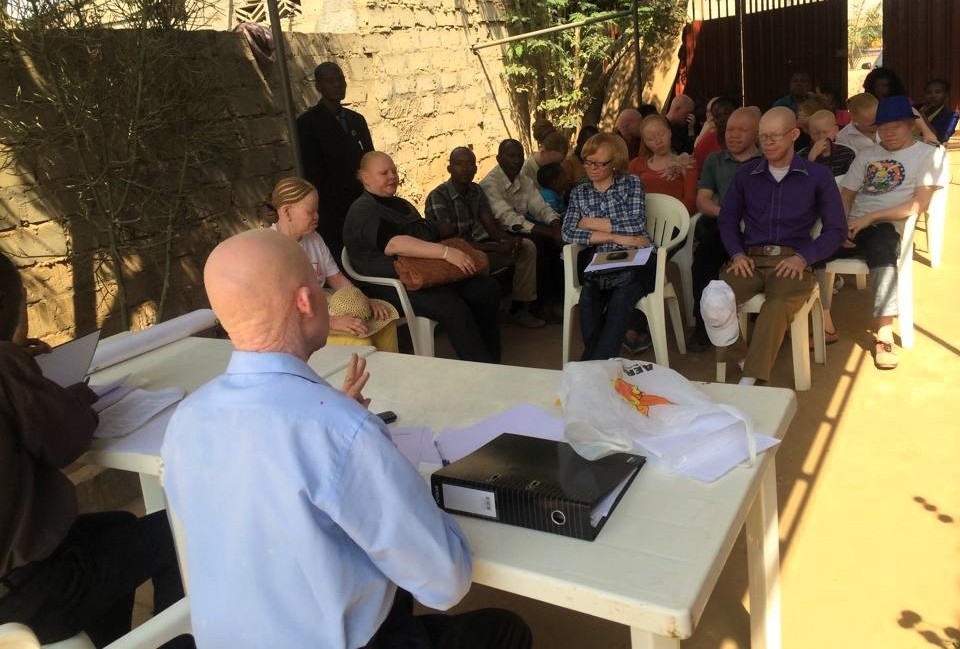 Angola: Cancro da pele continua a fazer vítimas entre albinos por falta de apoios