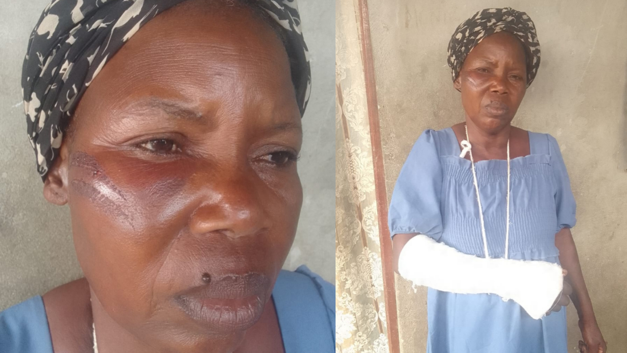 21 de Junho, 2025 Redação Polícia no Camama acusada de proteger fiscais que agrediram zungueiras no Calemba 2